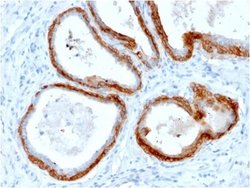 Cytokeratin, HMW Antibody (KRTH/2147R) - Azide and BSA Free, Novus Biologicals 100 &mu;g | Buy Online | Novus Biologicals | Fisher Scientific